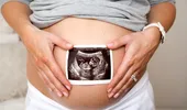 Dr. Viorica Rădoi, SANADOR: testele genetice din sarcină, dar și din perioada preconcepțională