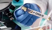 În ce constă tratamentul în spital al infecţiei cu noul coronavirus: propunere CDC