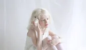 Fifty shades of white – un fotograf surprinde frumuseţea angelică a persoanelor bolnave de albinism