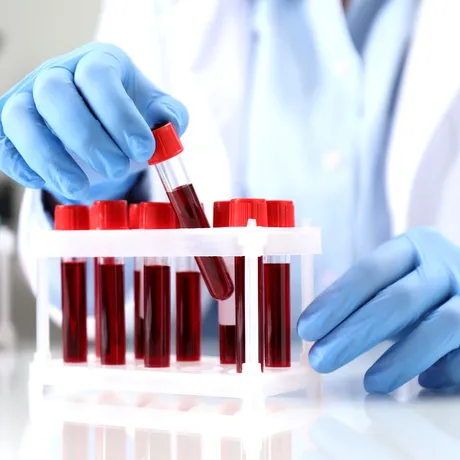 Boala Crohn ar putea fi depistată cu 10 ani înainte de diagnostic. Ce a dezvăluit un studiu recent