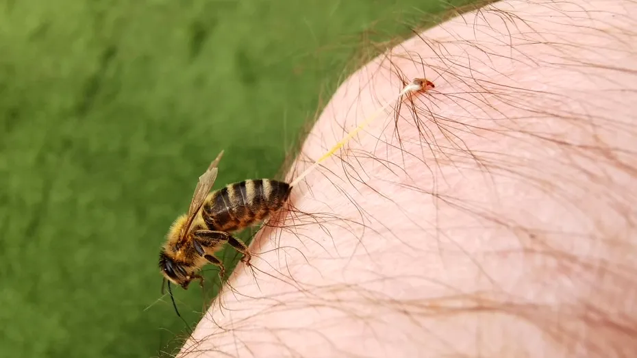 Cum te ferești de înțepătura de albină. Evită anumite parfumuri și culori! 10 sfaturi care îți pot salva viața