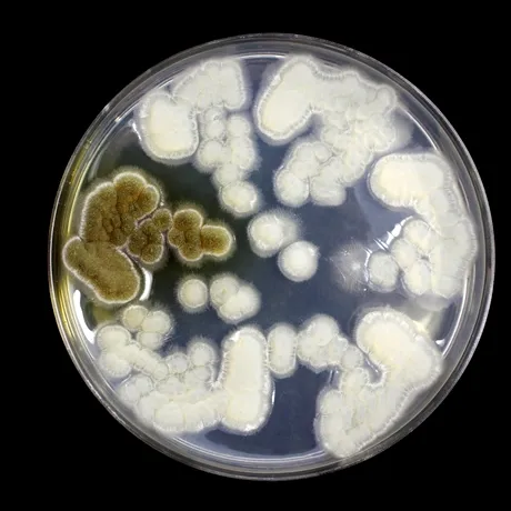 Ce este Candida Auris (Candidozyma Auris)? Ciuperca rezistentă amenință spitalele din întreaga Europă