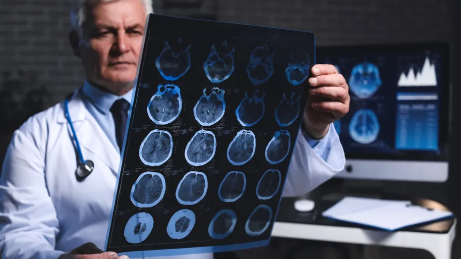 Semnul subtil al demenței. Primul simptom nu e pierderea memoriei