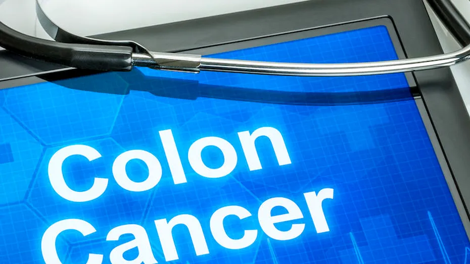 Dr. Ştefan Tucă: când se operează cancerul colorectal