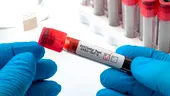 Cât timp persistă în sânge anticorpii dezvoltați în urma infecției cu SARS-CoV-2