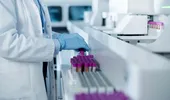 Poate fi depistat cancerul printr-o simplă analiză de sânge?