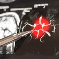 Ce se întâmplă când te repeți sau pui aceeași întrebare de mai multe ori. Problema de memorie la care te aștepți cel mai puțin