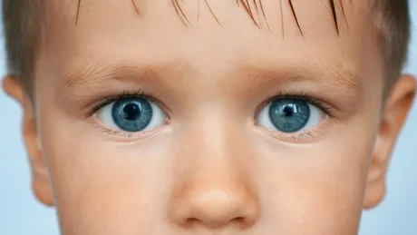 Anizocoria sau asimetria pupilelor poate ascunde boli grave. Explică dr. Ionela Iosub, medic oftalmolog