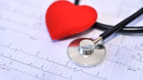 Electrocardiograma: tot ce trebuie să știi despre metoda de monitorizare a sănătății inimii