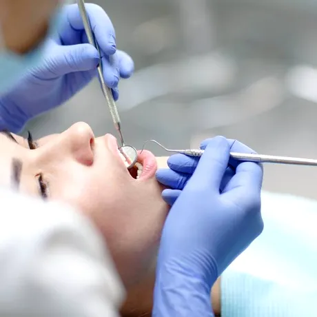 Ce să NU faci niciodată înainte să ajungi la dentist. De ce nu e bine să bei cafea sau să porți lentile de contact