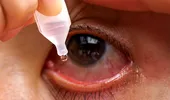 De ce nu e bine să folosești picături de ochi în fiecare zi. Uneori pot masca o infecție cu una dintre cele mai „încăpățânate” bacterii