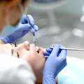 Servicii stomatologice decontate de CNAS în 2026. Cum poți merge la dentist gratuit și ce tratamente sunt incluse?