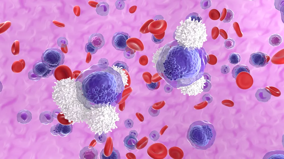 Inflamațiile, mutațiile genetice și leucemia. Studiul Oxford care oferă noi perspective în tratamentul cancerului