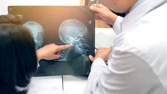 Cum se manifestă cancerele de cap și gât și cum trebuie tratate?