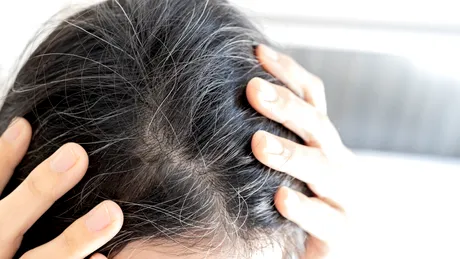 Fructul care te ajută să scapi de firele albe de păr FĂRĂ să te vopsești. Costă DOAR 5 lei