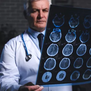 Semnul subtil al demenței. Primul simptom nu e pierderea memoriei