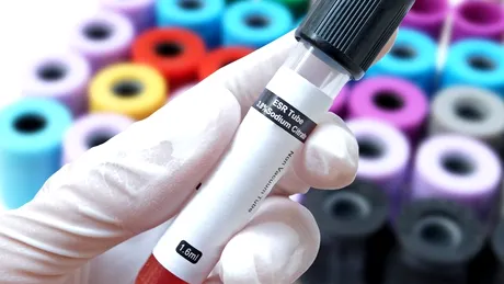 Hiponatremie (intoxicaţie cu apă): cauze, simptome, tratament