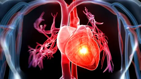 Miocardita: cauze, simptome, complicații, tratament