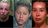 De ce li s-a umflat, de fapt, fața vedetelor de la „Survivor”? Adevărul din spatele transformărilor care au stârnit controverse