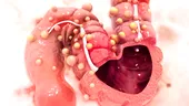 7 semne că ești expus unui risc mare de a dezvolta cancer de colon