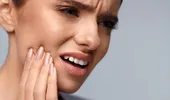 6 motive pentru care apar durerile dentare chiar dacă nu ai carii