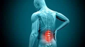 Radiculopatia lombară (durerile de spate): semne și simptome, diagnostic și tratament. Dr. Ovidiu Cristian Chiriac: „Cel mai important factor care conduce la apariția radiculopatiei lombare este hernia de disc”
