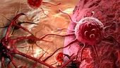Ce este cancerul: diferenţa dintre celulele normale şi cele afectate