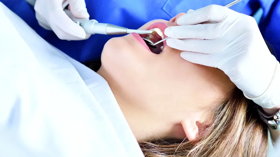 5 remedii naturale pentru gingivită