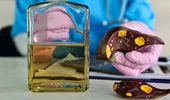 Organele vitale care se vindecă cel mai greu. Nu se regenerează deloc precum ficatul