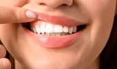 Cum să obții dinți mai albi acasă. Rețeta naturală pentru un zâmbet ca la Hollywood