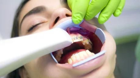 Inovații în tratamentul ortodontic. De la diagnostic la aparate dentare care reduc durata de tratament cu minimum șase luni