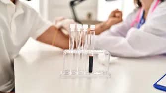 Poate o simplă analiză de sânge să arate cancerul? Ce trebuie să știi despre hemogramă