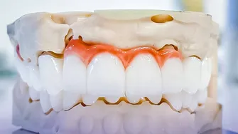 (P) Estetică fără compromis: De ce implantul dentar e cea mai naturală soluție