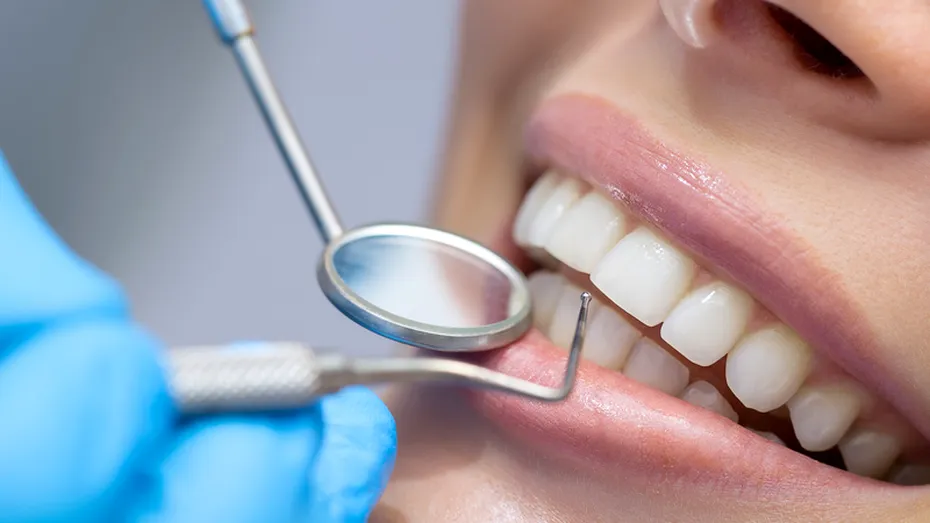 Pătarea dinţilor: cauze şi metode de tratament