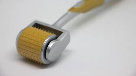 Tratamentul cu microneedling pentru scalp: ce este și care sunt riscurile procedurii