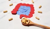 Intoleranța la histamină, afecțiunea despre care puțini au auzit. Cauze, simptome și tratament!