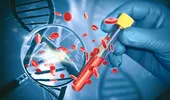 Test revoluționar pentru cancerul pancreatic asimptomatic: acuratețe de 97% și speranțe pentru depistarea bolii în stadii incipiente