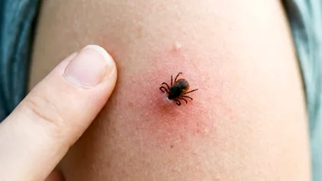 Cum să te ferești de mușcăturile și înțepăturile de insecte: țânțari, căpușe sau păianjeni