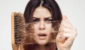Căderea în exces a părului, un nou simptom al coronavirusului