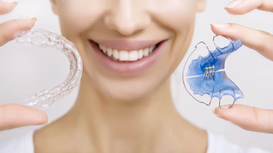 Aparatul preortodontic: când se recomandă