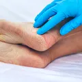 Semn neobișnuit la nivelul picioarelor care ar putea indica probleme hepatice. Medic: „Ficatul transmite semnale prin piele”