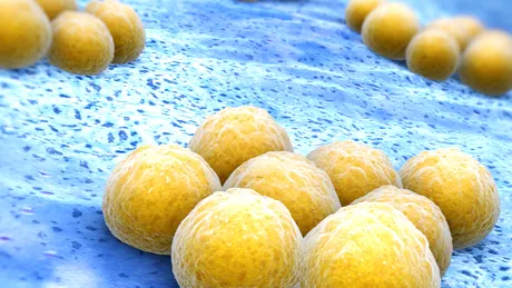 Staphylococcus aureus (stafilococul auriu) - ce este, ce simptome apar, când este periculos pentru sănătate și cum se tratează. Explică dr. Tatiana Popescu