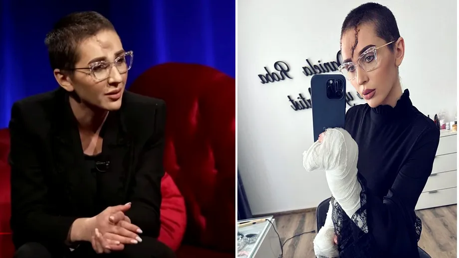 Dana Roba va suferi o operație de reconstrucție a craniului: Va fi o intervenție grea, mă vor tăia de la o ureche la alta