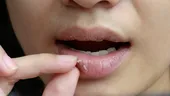 Cum tratezi natural buzele uscate și crăpate. Remedii naturale care vindecă buzele iarna