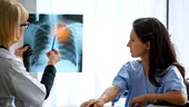 4 lucruri pe care să le faci chiar de azi pentru a-ți reduce riscul de cancer pulmonar