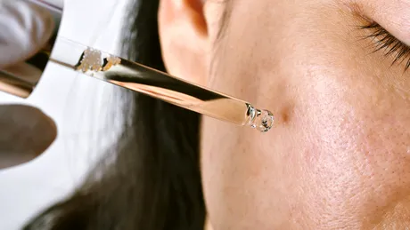 Cum ții sub control tenul gras și excesul de sebum