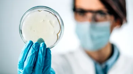 Probioticele „personalizate” ar putea reduce glicemia și grăsimea corporală. Ce arată studiile?