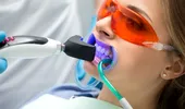 Albirea profesională a dinților – de câte ori se poate face într-un an?