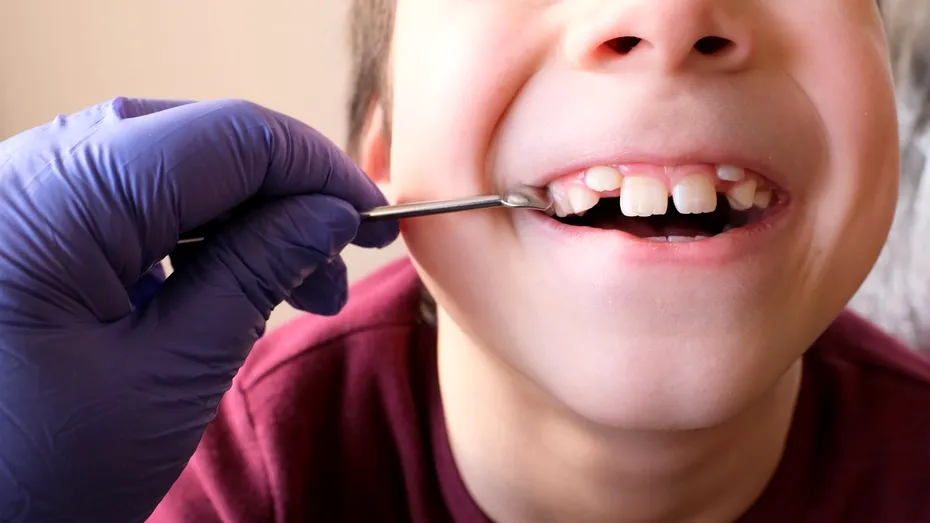 O treime dintre părinții români nu-și duc copiii la dentist, din lipsa banilor