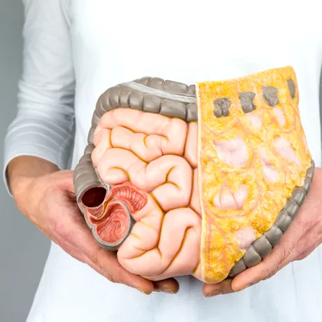 Semne ale cancerului de colon la tineri. Avertismentul transmis de un medic gastroenterolog